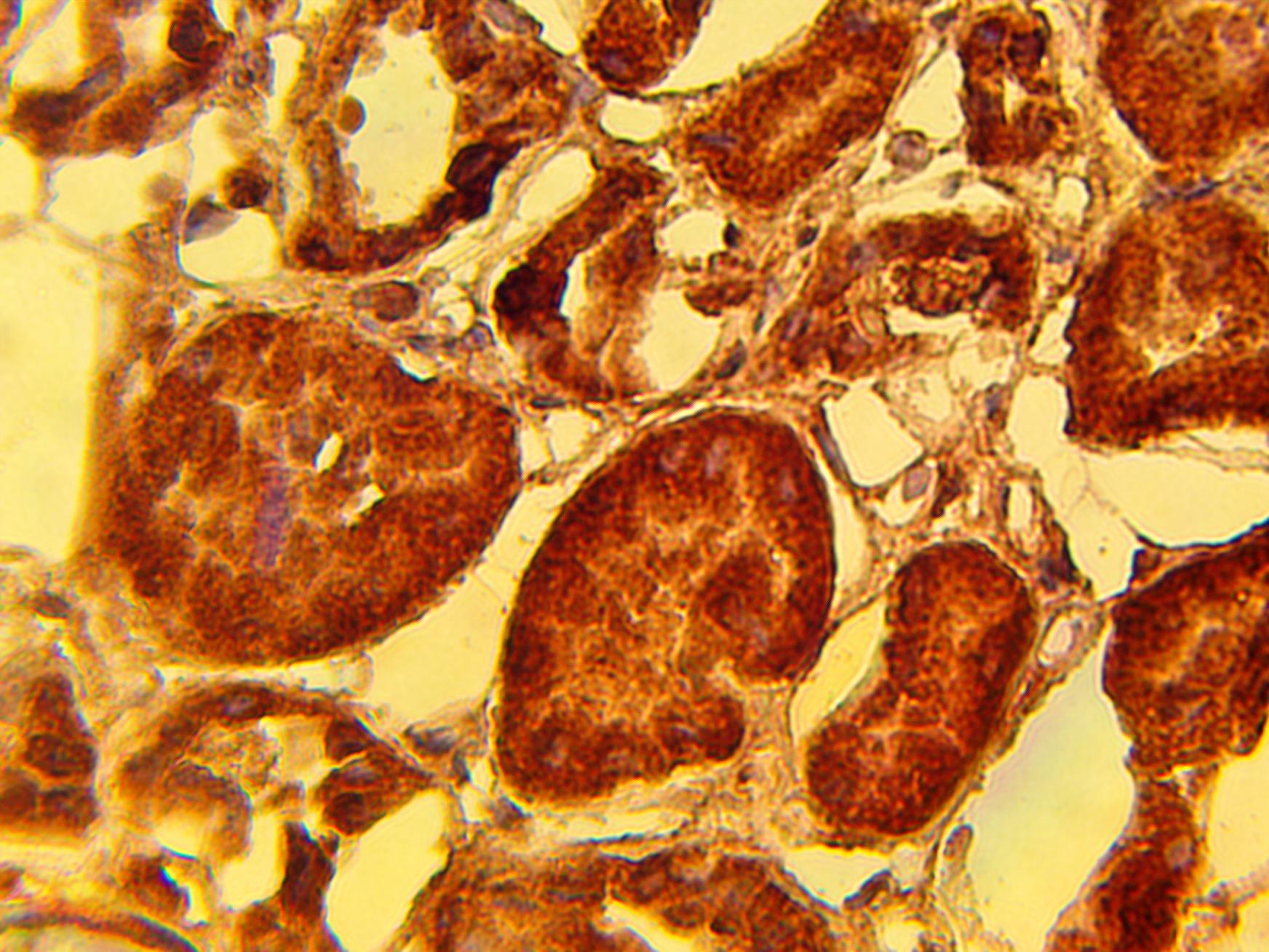Immunohistochemical staining of normal human kidney tissue using PHLPP2 antibody (Cat. No. X2737P) at 15 µg/ml and detected using anti-Rabbit HRP secondary antibody and visualized using DAB substrate and hematoxylin counterstain.
